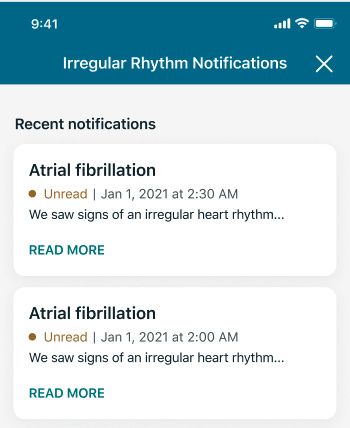 Irregular heart rhythm notifications screenshot