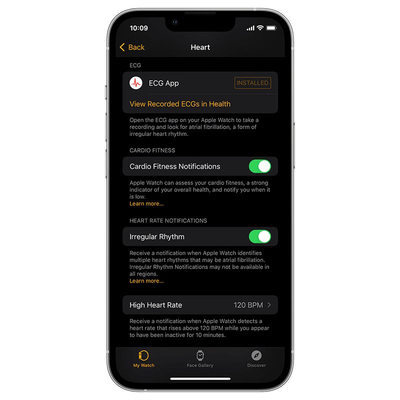 Irregular Rhythm notification feature screenshot on iPhone.