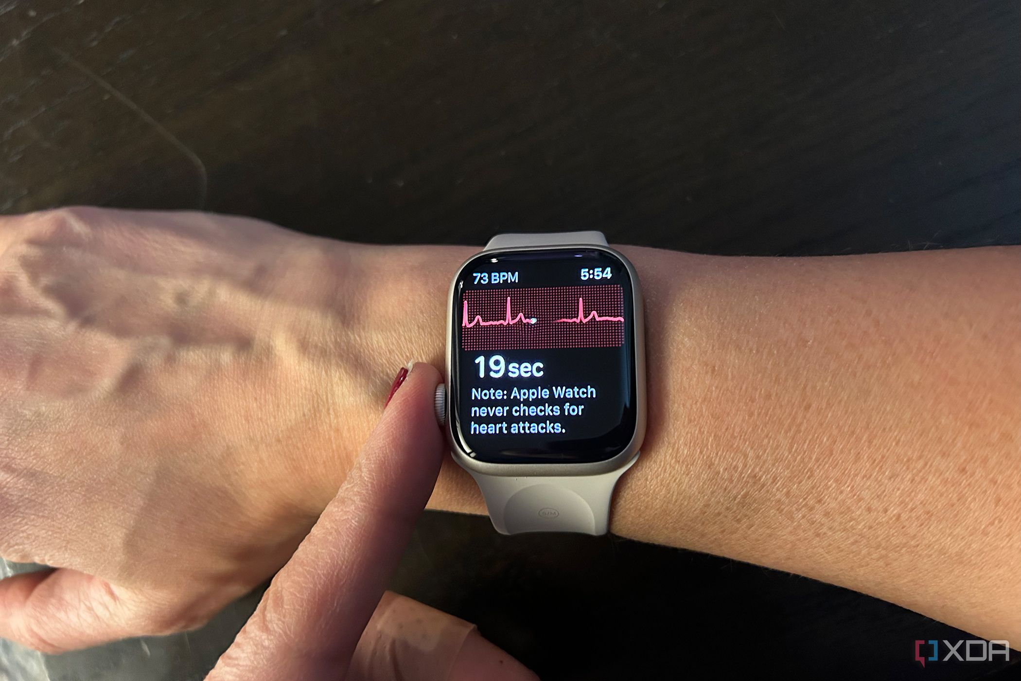 apple watch ecg 6